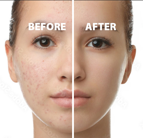 Photo retouching example